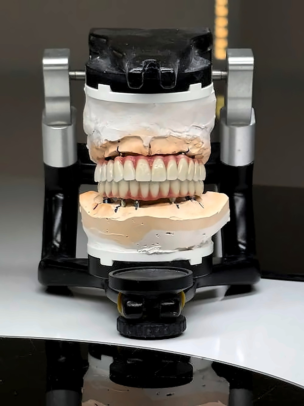 Modelo odontologico montado em articulador de laboratorio