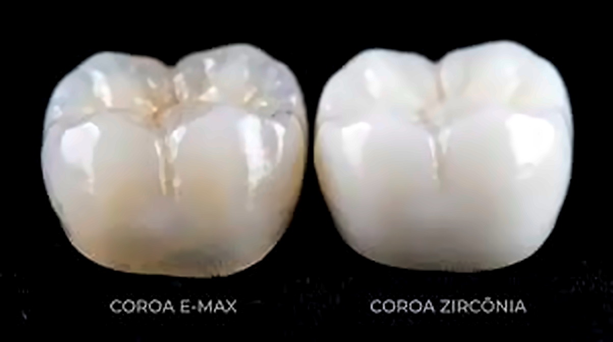 Comparacao visual entre coroa E-max e coroa de zirconia