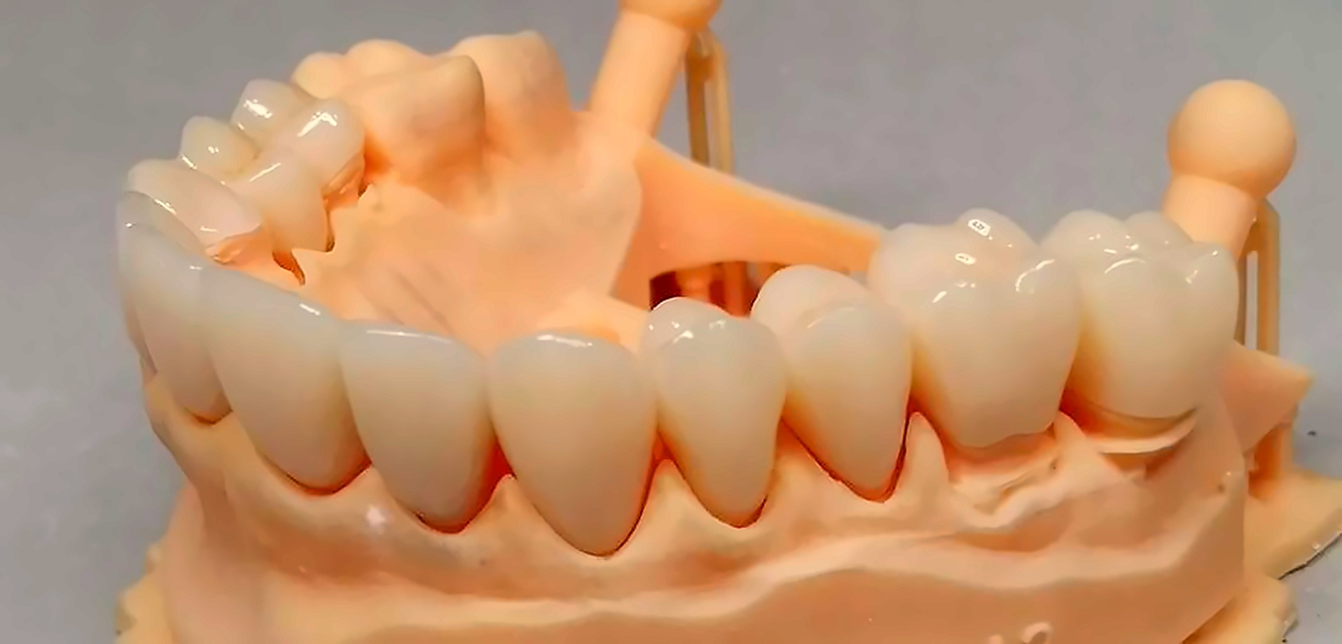 Modelo de arcada com dentes artificiais em bancada